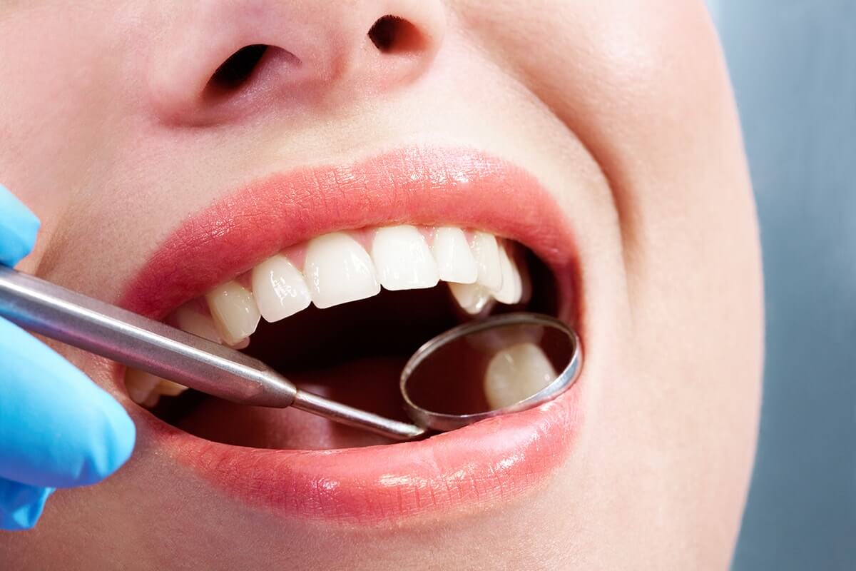 hygienist Richmond
