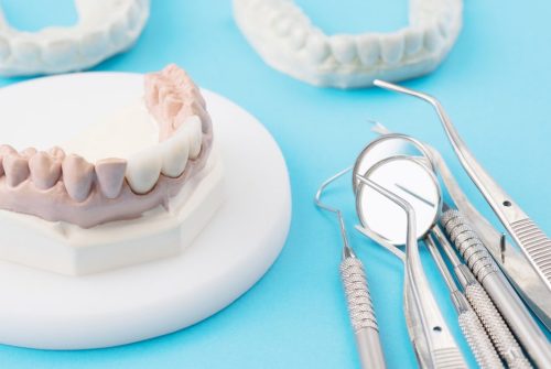 Advancing Your Oral Health with Expert Hygienists in Richmond